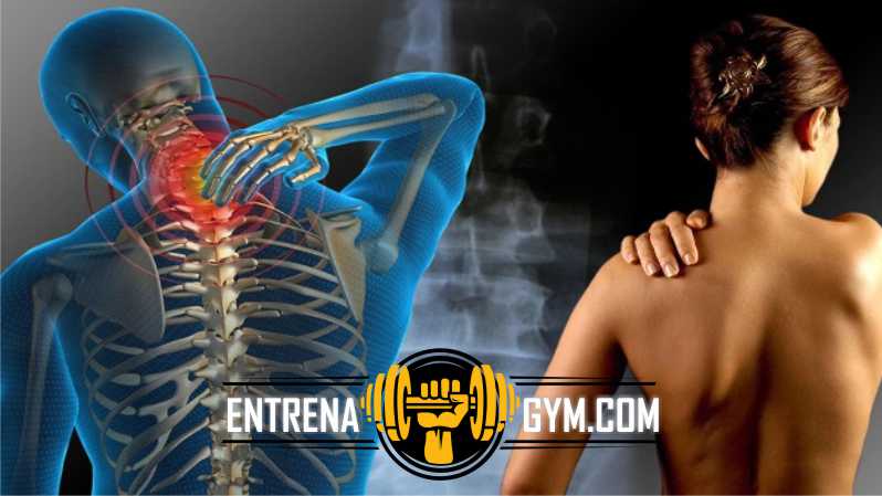 dolor de cuello